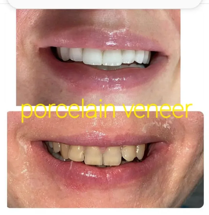 Alanya HEALTHY TEETH Dental Aesthetic — Medicina em Alanya: Encomenda online, preços e comentários